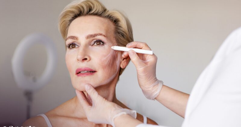Closeup of mature woman with face contour lines during anti-aging consultation at beauty clinic. Dermatologist preparing for cosmetic facelift procedure. Skincare, rejuvenation and aesthetic treatment