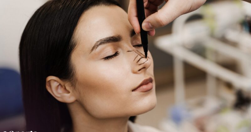 preoperative-rhinoplasty-markings-on-nose-by-ent-d-2026-02-15-00-51-06-utc