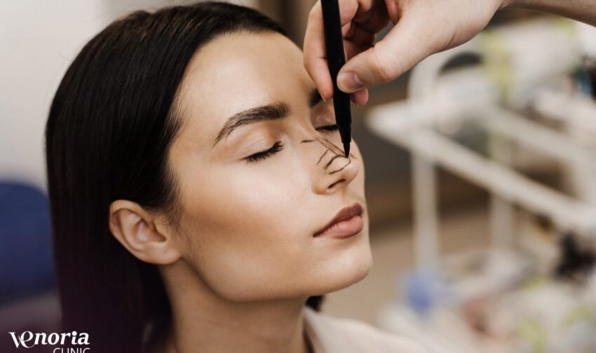 preoperative-rhinoplasty-markings-on-nose-by-ent-d-2026-02-15-00-51-06-utc